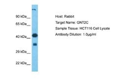 GCNT2 Antibody, Novus Biologicals 100 &mu;L; Unconjugated:Antibodies, Polyclonal